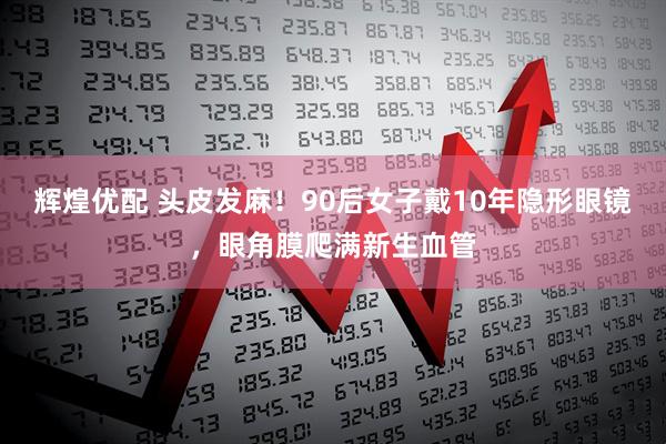 辉煌优配 头皮发麻！90后女子戴10年隐形眼镜，眼角膜爬满新生血管